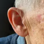 BTE Rechargeable Hearing Aids (Pair Of 2) - Image 2